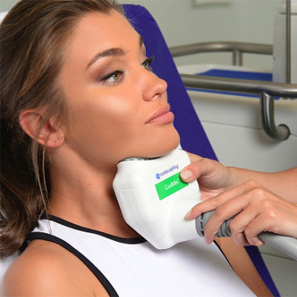 CoolSculpting® Submental (Under Chin)