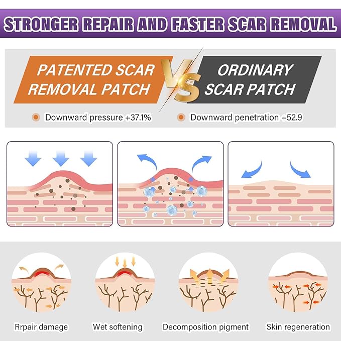 Silicone Scar Removal Strips for Surgical