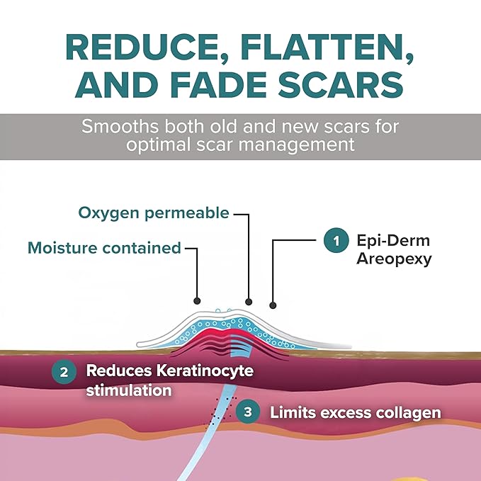 Silicone Scar Sheets