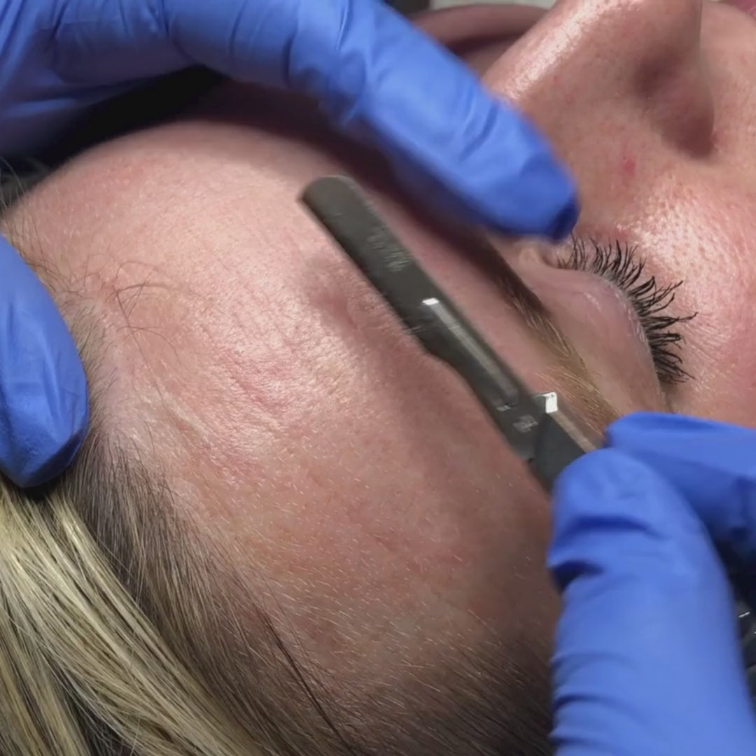 Dermaplane