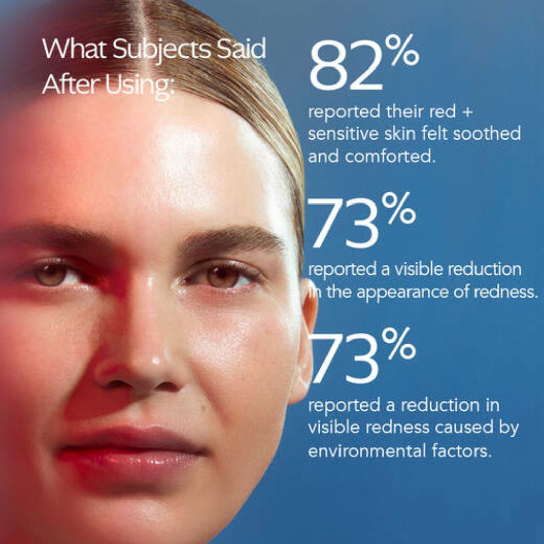 Rosacea Relief Skincare Bundle