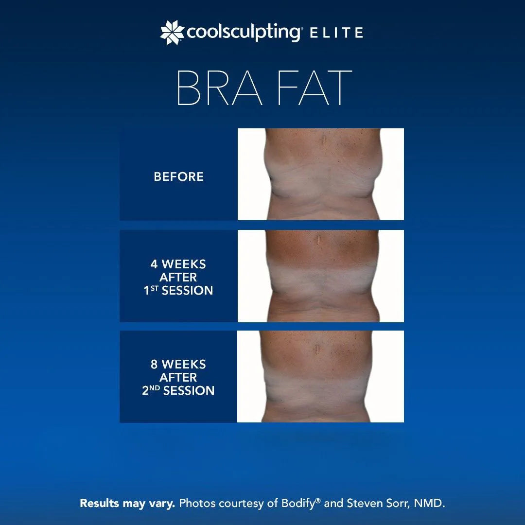 CoolSculpting® Elite
