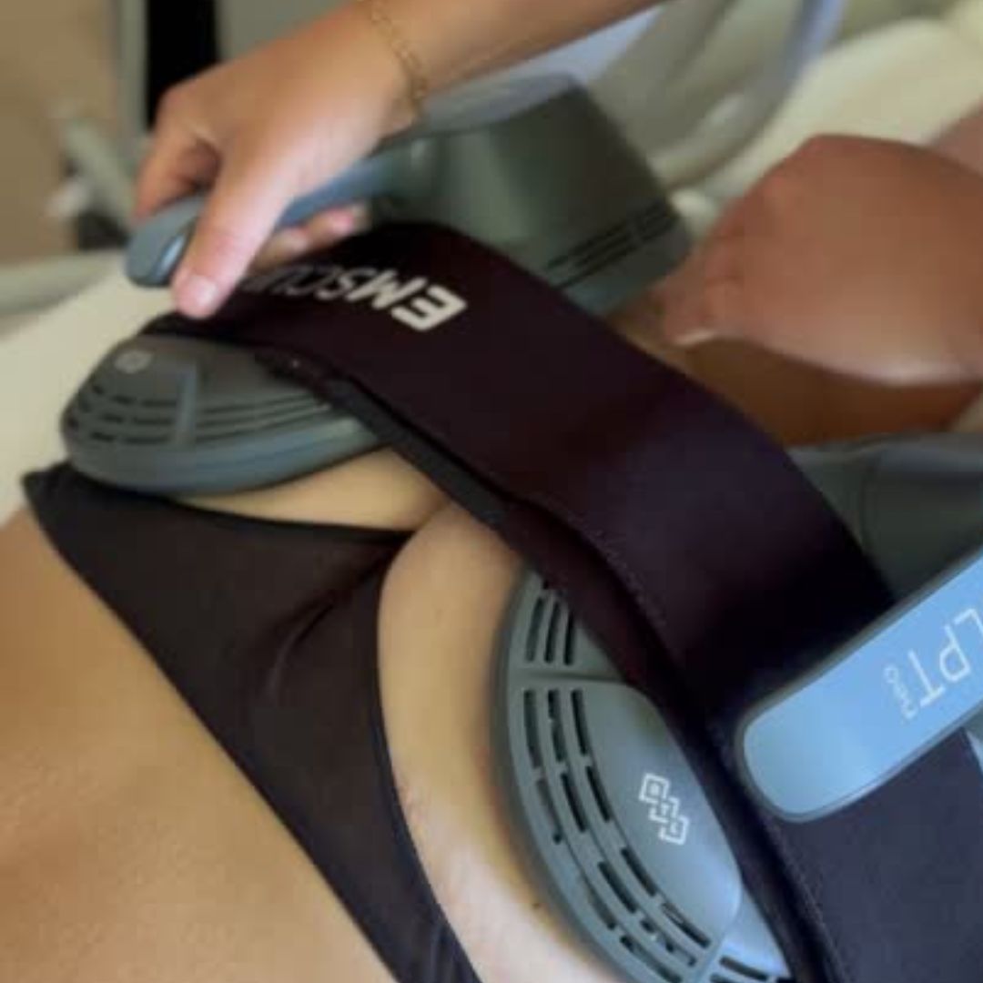 Emsculpt NEO: Sun&