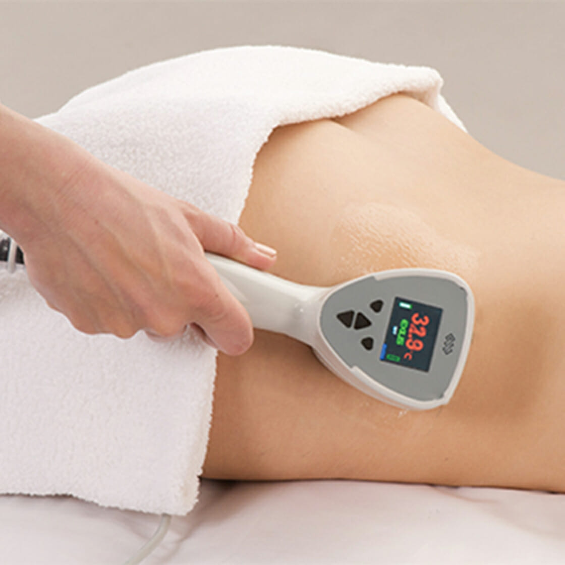 Exilis Elite - Large Area Treatment