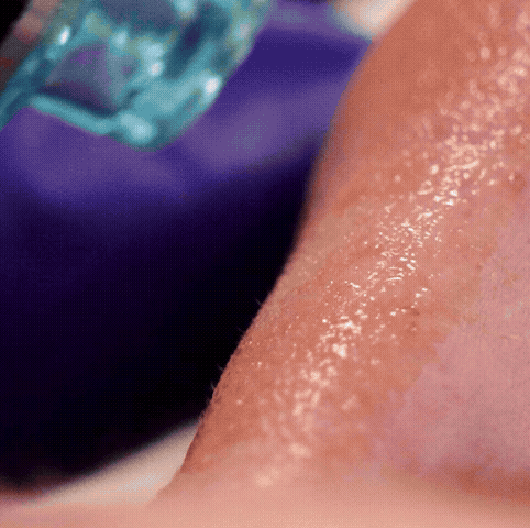 Hydrafacial