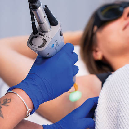 Laser Hair Removal