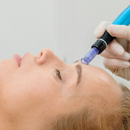 Exceedâ„¢ Microneedling