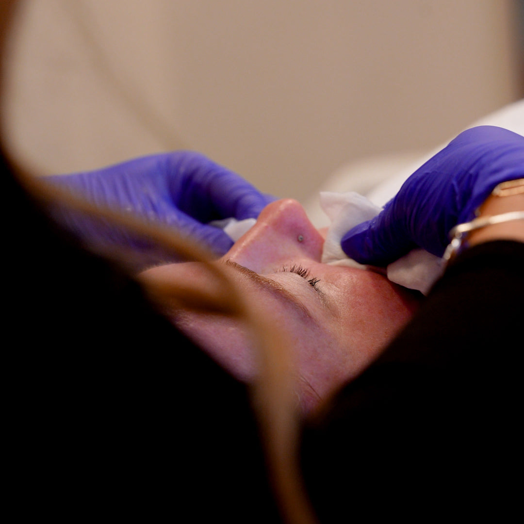 SkinMedica Vitalize Peel