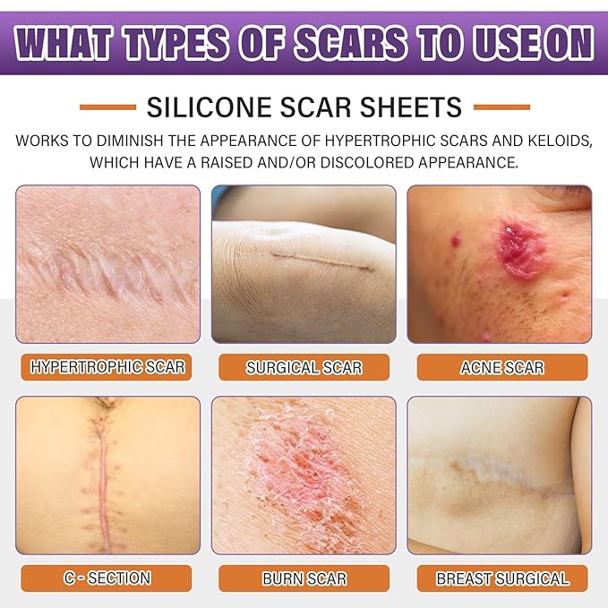 Silicone Scar Removal Strips for Surgical