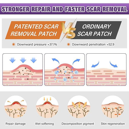 Silicone Scar Removal Strips for Surgical