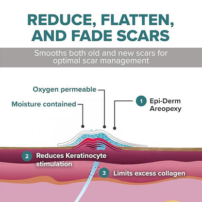 Silicone Scar Sheets