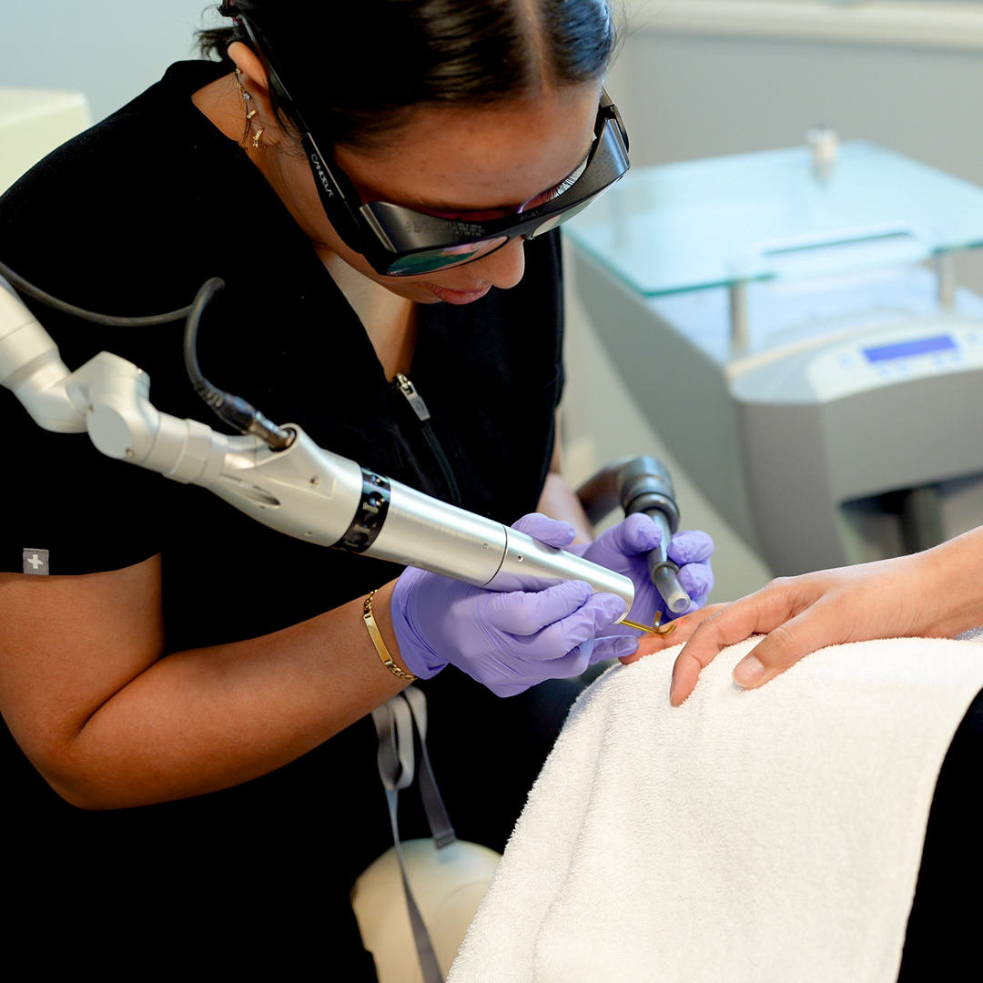 PicoWay Tattoo Removal