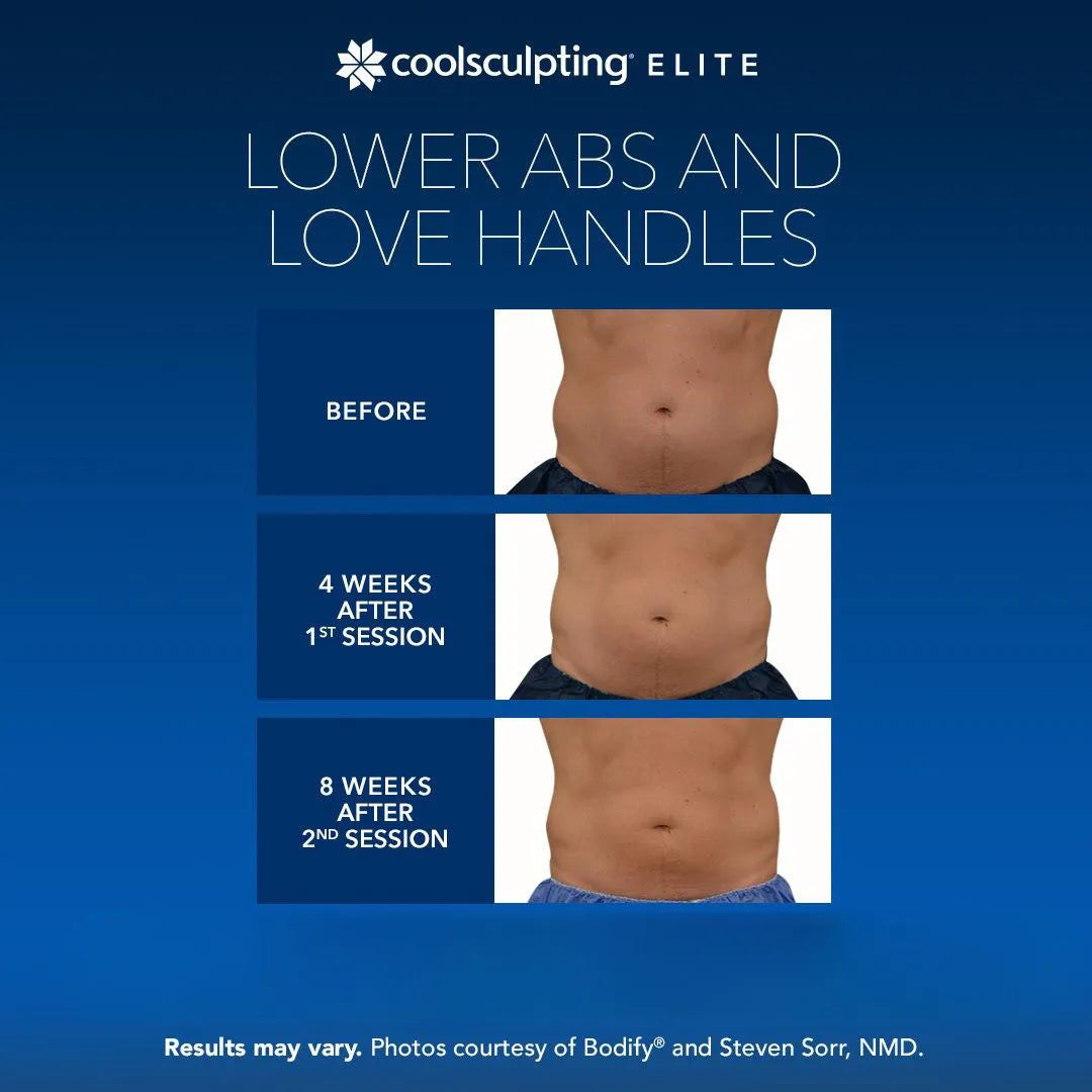 CoolSculpting® Elite