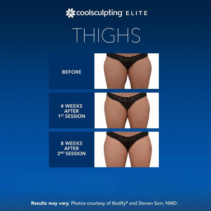 CoolSculpting® Elite