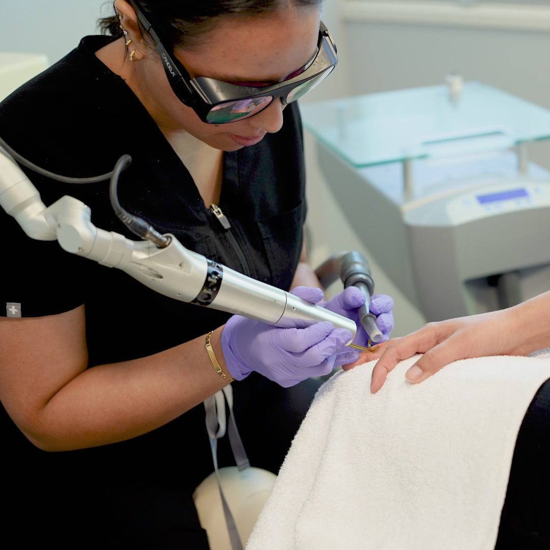 PicoWay Tattoo Removal