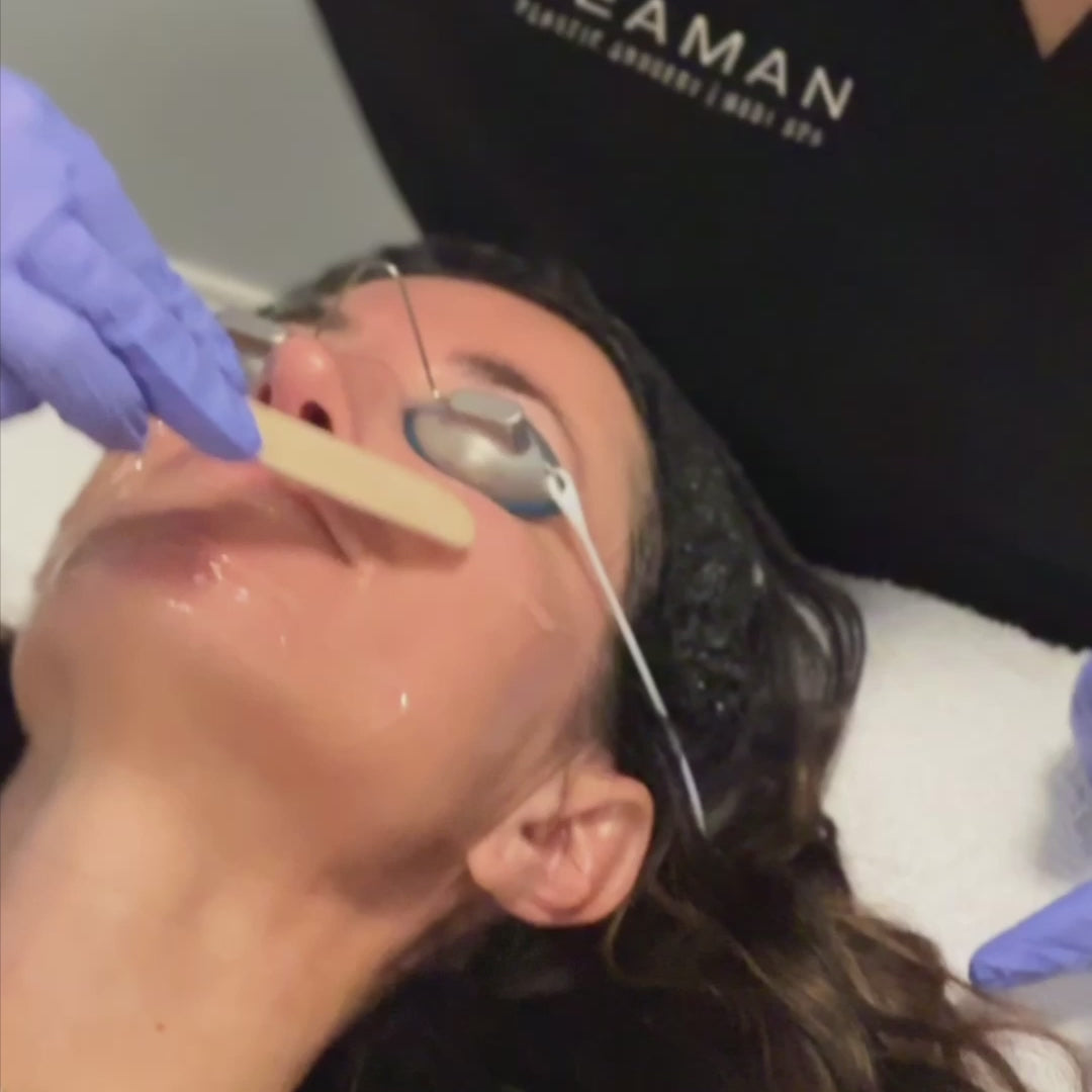 BroadBand Light (BBL™) Treatment