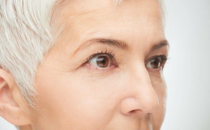 PRP/PRF  Under Eye Injections