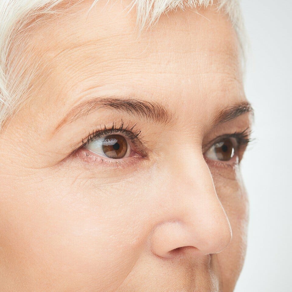 PRP/PRF  Under Eye Injections